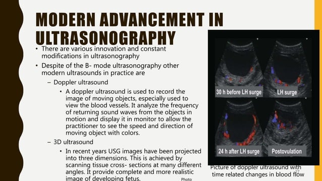 Transrectal ultrasonography in reproductive management of cattle | PPTX