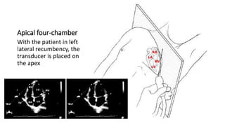 Apical four-chamber
With the patient in left
lateral recumbency, the
transducer is placed on
the apex
 