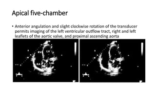 Apical five-chamber
• Anterior angulation and slight clockwise rotation of the transducer
permits imaging of the left ventricular outflow tract, right and left
leaflets of the aortic valve, and proximal ascending aorta
 