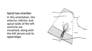 Apical two-chamber
In this orientation, the
anterior, inferior, and
apical walls of the left
ventricle are
visualized, along with
the left atrium and its
appendage.
 
