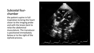Subcostal four-
chamber
the patient supine in full
inspiration to bring the heart
closer to the imaging probe
and with the knees bent to
relax the abdominal
musculature. The transducer
is positioned immediately
below or to the right of the
xiphoid process.
 
