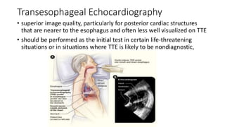 Transesophageal Echocardiography
• superior image quality, particularly for posterior cardiac structures
that are nearer to the esophagus and often less well visualized on TTE
• should be performed as the initial test in certain life-threatening
situations or in situations where TTE is likely to be nondiagnostic,
 