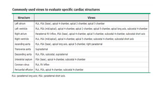 Transthoracic Echocardiogram, 3D, Doppler, TEE.pptx
