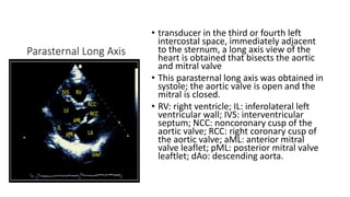 Parasternal Long Axis
• transducer in the third or fourth left
intercostal space, immediately adjacent
to the sternum, a long axis view of the
heart is obtained that bisects the aortic
and mitral valve
• This parasternal long axis was obtained in
systole; the aortic valve is open and the
mitral is closed.
• RV: right ventricle; IL: inferolateral left
ventricular wall; IVS: interventricular
septum; NCC: noncoronary cusp of the
aortic valve; RCC: right coronary cusp of
the aortic valve; aML: anterior mitral
valve leaflet; pML: posterior mitral valve
leaftlet; dAo: descending aorta.
 