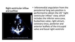 Right ventricular inflow
and outflow
• Inferomedial angulation from the
parasternal long axis position is
performed to obtain the 2D "right
ventricular inflow" view, which
includes the inferior vena cava,
Eustachian valve, right atrium,
coronary sinus, posterior and
anterior leaflets of the tricuspid
valve and basal right ventricle
 