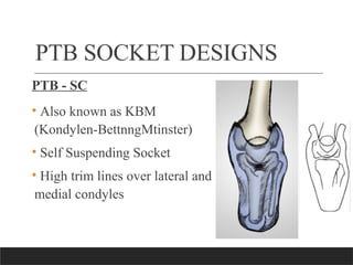 Ptb Socket Design Comprehensive Overview of Transtibial Prosthetic Socket Designs and ...