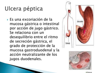  Es una excoriación de la
mucosa gástrica o intestinal
por acción de jugo gástrico.
Se relaciona con un
desequilibrio entre el ritmo
de secreción gástrica, el
grado de protección de la
mucosa gastroduodenal y la
acción neutralizante de los
jugos duodenales.
 