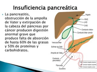  La pancreatitis,
obstrucción de la ampolla
de Vater y extirpación de
la cabeza del páncreas por
cáncer producen digestión
anormal grave que
produce falta de absorción
de hasta 60% de las grasas
y 50% de proteínas y
carbohidratos.
Insuficiencia pancreática
 