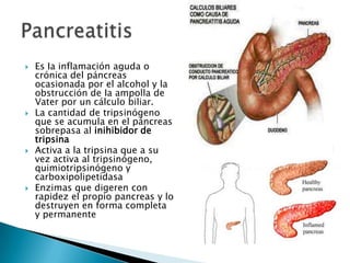  Es Ia inflamación aguda o
crónica del páncreas
ocasionada por el alcohol y la
obstrucción de Ia ampolla de
Vater por un cálculo biliar.
 La cantidad de tripsinógeno
que se acumula en el páncreas
sobrepasa al inihibidor de
tripsina
 Activa a la tripsina que a su
vez activa al tripsinógeno,
quimiotripsinógeno y
carboxipolipetidasa
 Enzimas que digeren con
rapidez el propio pancreas y lo
destruyen en forma completa
y permanente
 