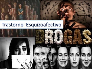 Trastorno Esquizoafectivo
 