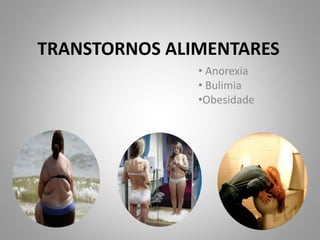 TRANSTORNOS ALIMENTARES
• Anorexia
• Bulimia
•Obesidade
 