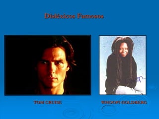 TOM CRUISE WHOOPI GOLDBERG
Disléxicos Famosos
 
