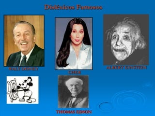 ALBERT EINSTEIN
CHER
WALT DISNEY
Disléxicos Famosos
THOMAS EDSON
 