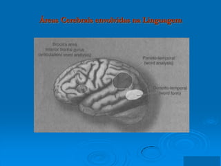 Áreas Cerebrais envolvidas na Linguagem
 