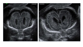 G.MALINGER G.MALINGER
 