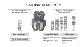TRANSTORNOS DE MIGRACIÓN
 