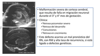27
ss
• Malformación severa de corteza cerebral,
que resulta de falla en migración neuronal
durante el 3° y 4° mes de gestación.
• Clínica:
Retraso psicomotor severo
Retraso del desarrollo
Convulsiones
Retraso en crecimiento
• Este defecto acarrea un mal pronóstico del
RN, con RM y alta tasa de recurrencia, si está
ligado a defectos genéticos.
 