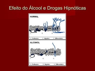 Efeito do Álcool e Drogas HipnóticasEfeito do Álcool e Drogas Hipnóticas
 
