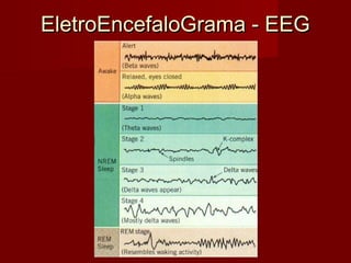 EletroEncefaloGrama - EEGEletroEncefaloGrama - EEG
 