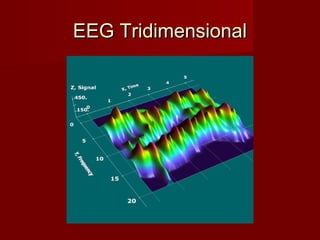 EEG TridimensionalEEG Tridimensional
 