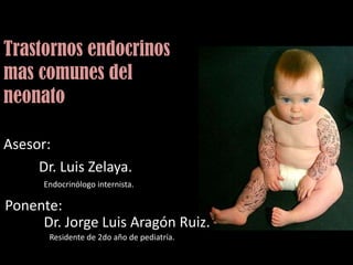 Trastornos endocrinos mas comunes del neonato Asesor: 	Dr. Luis Zelaya. Endocrinólogo internista. Ponente: Dr. Jorge Luis Aragón Ruiz. Residente de 2do año de pediatría. 