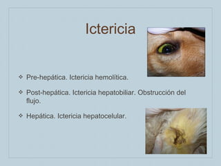 Ictericia
❖

Pre-hepática. Ictericia hemolítica.

❖

Post-hepática. Ictericia hepatobiliar. Obstrucción del
flujo.

❖

Hepática. Ictericia hepatocelular.

 