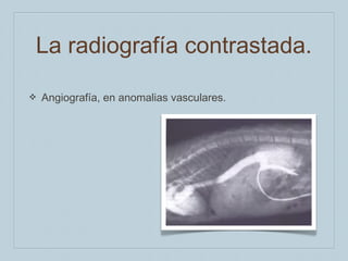 La radiografía contrastada.
❖

Angiografía, en anomalias vasculares.

 