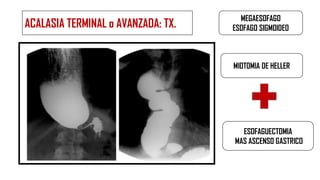 Trastornos motores 2024.pdf Gastroenterología 2024 tema de Trastornos ...