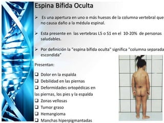 Espina Bífida Oculta
 Es una apertura en uno o más huesos de la columna vertebral que
no causa daño a la médula espinal.
 Esta presente en las vertebras L5 o S1 en el 10-20% de personas
saludables.
 Por definición la "espina bífida oculta" significa "columna separada
escondida“
Presentan:
 Dolor en la espalda
 Debilidad en las piernas
 Deformidades ortopédicas en
las piernas, los pies y la espalda
 Zonas vellosas
 Tumor graso
 Hemangioma
 Manchas hiperpigmantadas
 
