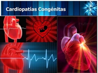 Cardiopatías Congénitas
 
