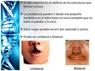  El labio leporino es un defecto de las estructuras que
forman la boca.
 Los problemas pueden ir desde una pequeña
hendidura en el labio hasta un surco completo que va
hasta el paladar y la nariz.
 Estos rasgos pueden ocurrir por separado o juntos.
 Puede ser unilateral o bilateral
Unilateral Bilateral
 