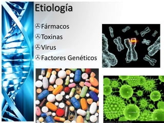 Etiología
Fármacos
Toxinas
Virus
Factores Genéticos
 