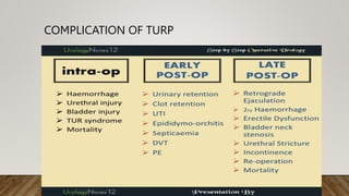TRANSURETHRAL RESECTION OF PROSTATE.pptx