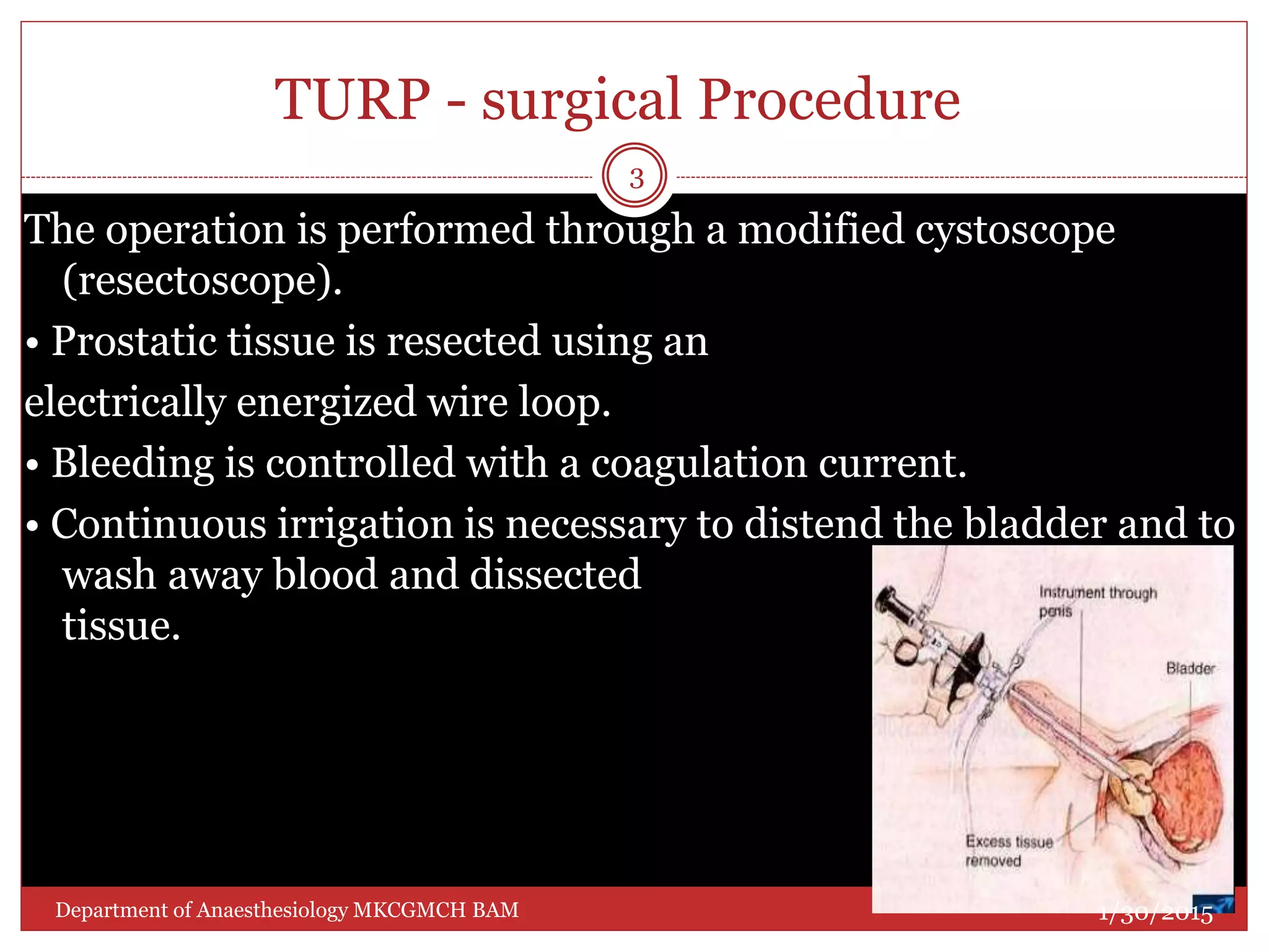 TURP - surgical Procedure
The operation is performed through a modified cystoscope
(resectoscope).
• Prostatic tissue is resected using an
electrically energized wire loop.
• Bleeding is controlled with a coagulation current.
• Continuous irrigation is necessary to distend the bladder and to
wash away blood and dissected prostatic
tissue.
1/30/2015
3
Department of Anaesthesiology MKCGMCH BAM
 