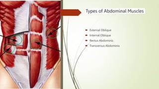 Types of Abdominal Muscles
 External Oblique
 Internal Oblique
 Rectus Abdominis
 Transversus Abdominis
 