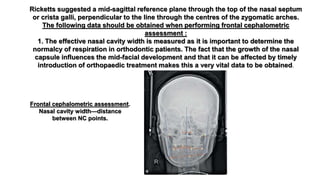 Ricketts Line Transverse discrepancies | PPTX