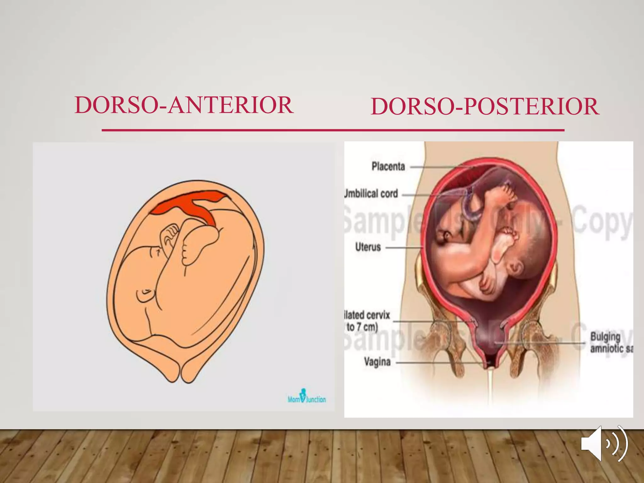 DORSO-ANTERIOR DORSO-POSTERIOR
 