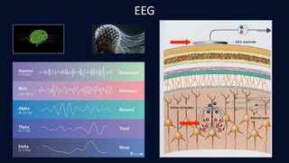 JO
EEG
 