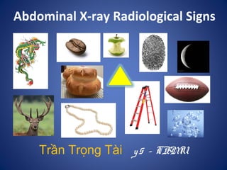 Abdominal X-ray Radiological Signs
Trần Trọng Tài y5 - TBMU
 