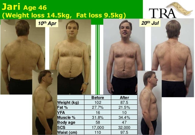 tra overview 33 bmi