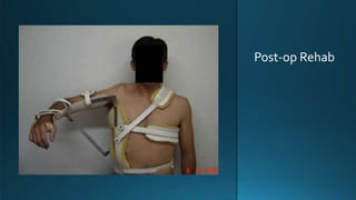 Post-op Rehab
 