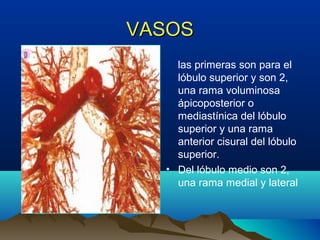 VASOSVASOS
las primeras son para el
lóbulo superior y son 2,
una rama voluminosa
ápicoposterior o
mediastínica del lóbulo
superior y una rama
anterior cisural del lóbulo
superior.
• Del lóbulo medio son 2,
una rama medial y lateral
 
