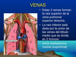 VENASVENAS
• Estas 3 ramas forman
la raíz superior de la
vena pulmonar
superior derecha.
• La raíz inferior está
dada por la unión de
las venas del lóbulo
medio que se divide
en 2 troncos:
• rama mediastínica
medial (superficial)
 