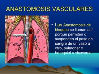 ANASTOMOSIS VASCULARESANASTOMOSIS VASCULARES
• Las Anastomosis de
bloqueo se llaman así
porque permiten o
suspenden el paso de
sangre de un vaso a
otro, pulmonar o
bronquial o viceversa.
 