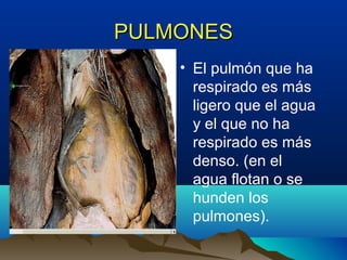 PULMONESPULMONES
• El pulmón que ha
respirado es más
ligero que el agua
y el que no ha
respirado es más
denso. (en el
agua flotan o se
hunden los
pulmones).
 