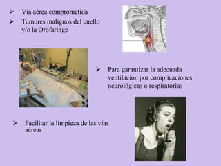    Vía aérea comprometida
   Tumores malignos del cuello
    y/o la Orofaringe




                                    Para garantizar la adecuada
                                     ventilación por complicaciones
                                     neurológicas o respiratorias




    Facilitar la limpieza de las vías
     aéreas
 