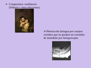  Compromiso ventilatorio
  (Difteria y otras afecciones)




                                  Obstrucción laríngea por cuerpos
                                  extraños que no pueden ser extraídos
                                  de inmediato por laringoscopia
 