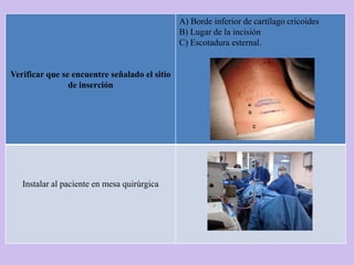A) Borde inferior de cartílago cricoides
                                               B) Lugar de la incisión
                                               C) Escotadura esternal.


Verificar que se encuentre señalado el sitio
                de inserción




   Instalar al paciente en mesa quirúrgica
 