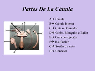 Partes De La Cánula
          A Cánula
          B Cánula interna
          C Guía u Obturador
          D Globo, Manguito o Balón
          E Cinta de sujeción
          F Insuflación
          G Sostén o careta
          H Conector
 