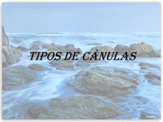 Tipos de cánulas
 